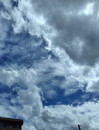 額の辺が痛いのは何故？